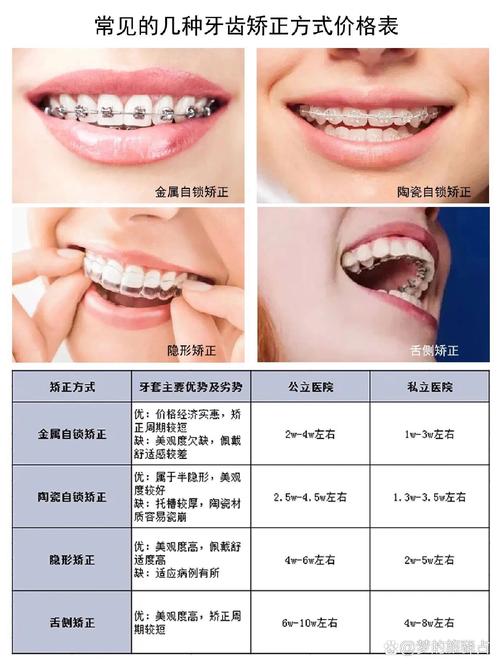 嘉兴牙齿矫正价格一般是多少？不同方案价格差多少？-图2