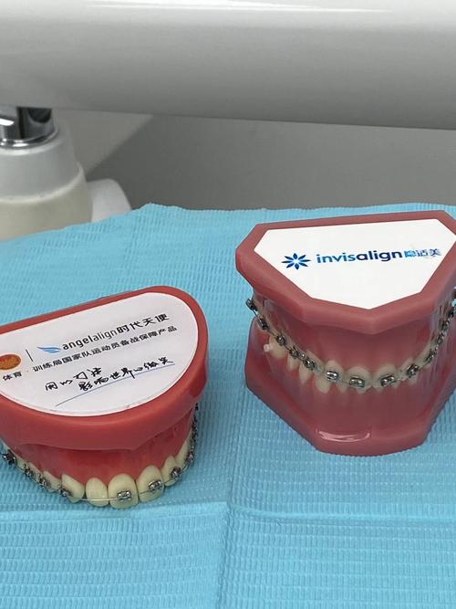 南京牙齿矫正便宜的靠谱吗？-图2