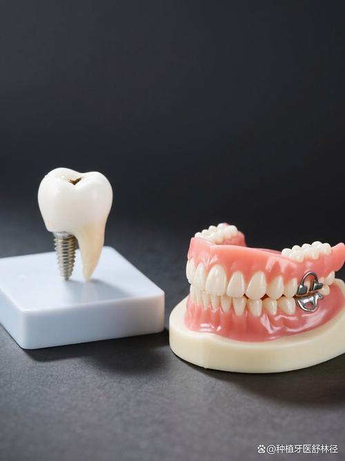 有假牙可以做牙齿矫正吗？-图1