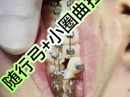 武汉矫正牙齿哪里好-图1