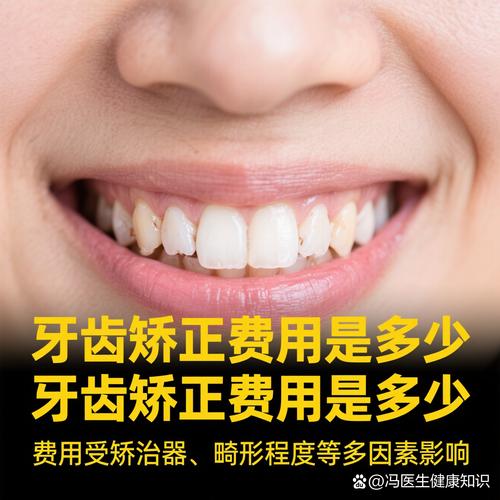 武汉哪里矫正牙齿好-图1