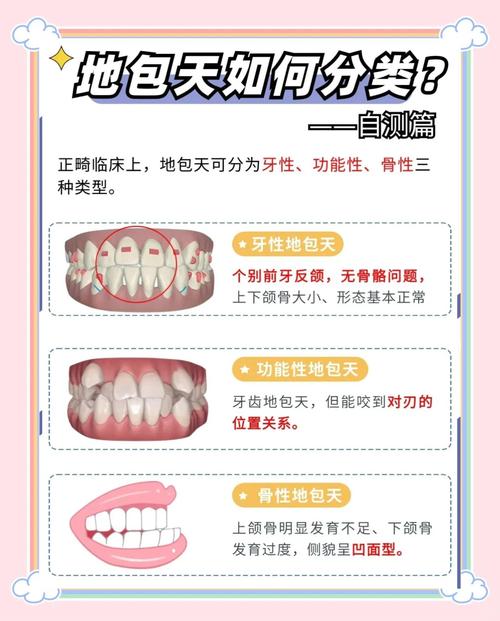 地包天矫正价格受哪些因素影响？大概要花多少钱？-图2