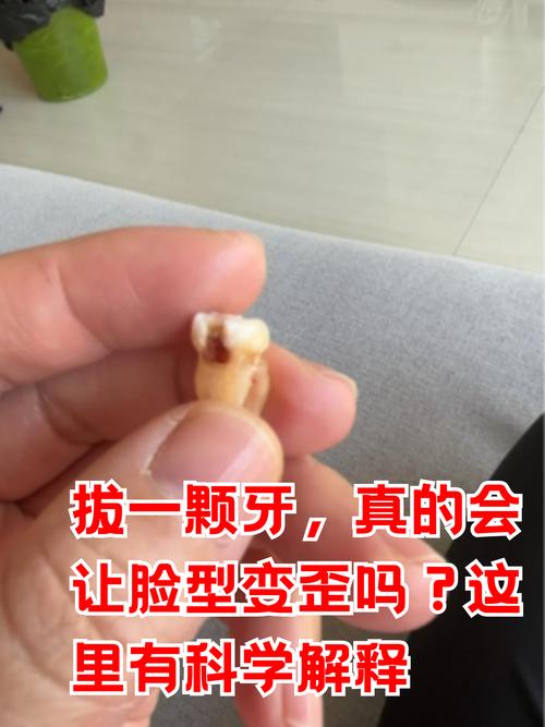 矫正牙齿拔了一颗牙-图1