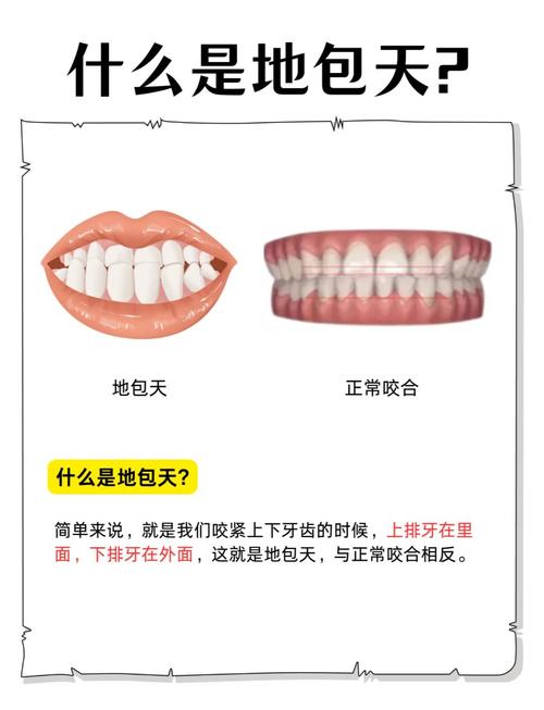 地包天矫正的最佳年龄是几岁？越早越好吗？-图2