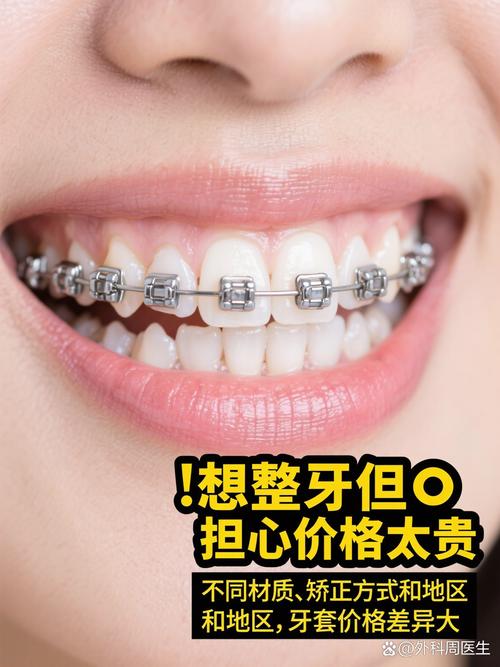 牙齿矫正哪种牙套好？隐形、金属怎么选？-图1