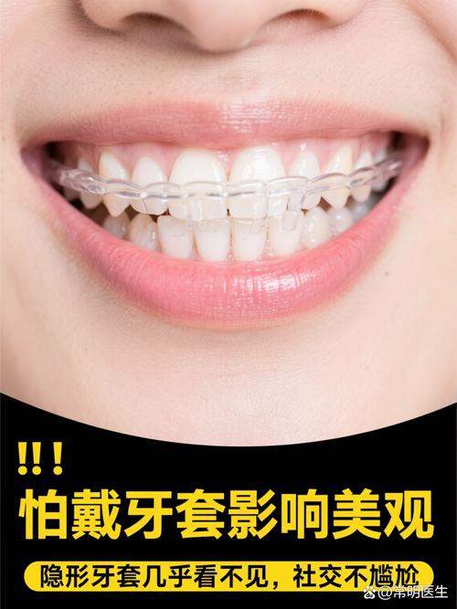 牙齿矫正哪种牙套好？隐形、金属怎么选？-图3