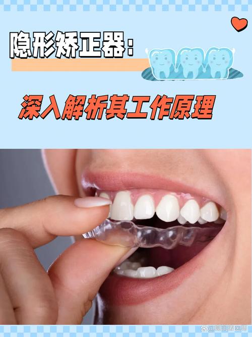 隐形牙齿矫正图片能直观看到矫正效果吗？-图1