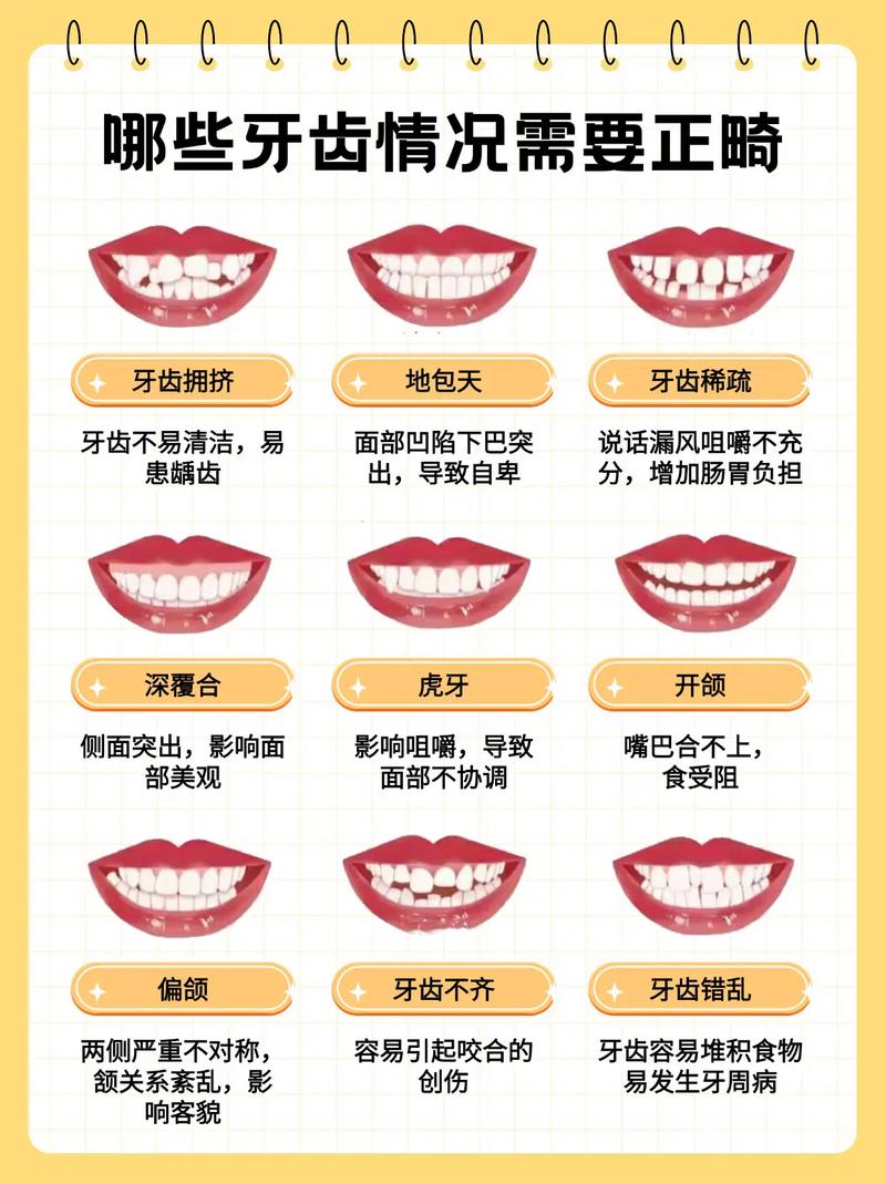矫正牙齿有哪些方法？传统、隐形等矫正方式怎么选？-图3