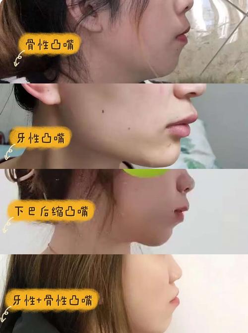 北京矫正牙齿哪里好？求推荐靠谱机构？-图2
