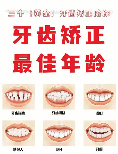 儿童牙齿矫正，几岁开始矫正效果最佳？-图2