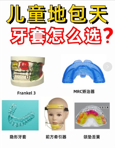 地包天牙齿矫正有哪些常用方法？-图2