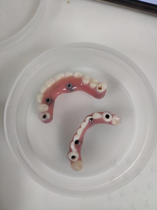 上海医院牙齿矫正哪家好？效果怎样？价格贵不贵？-图2