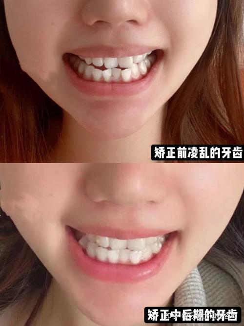 重庆矫正牙齿哪家好？从资质、口碑等方面怎么选机构？-图2