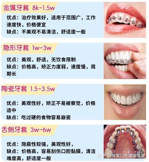 成都矫正牙齿大概多少钱？费用差异大吗？-图2