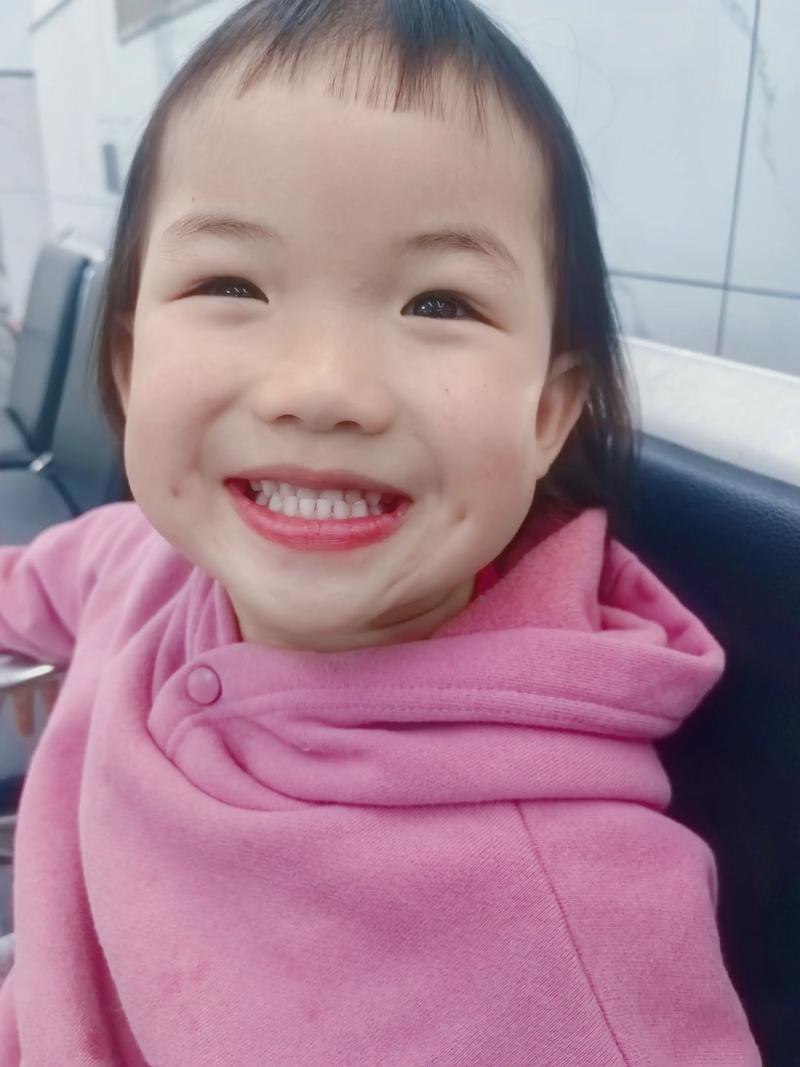 轻微天包地牙齿矫正，有必要做吗？效果如何？-图3