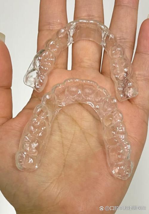 24岁矫正牙齿还来得及吗？-图2