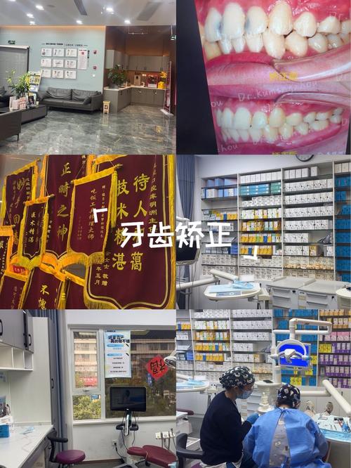 杭州矫正牙齿哪里好？专业机构怎么选？-图1