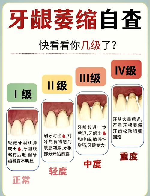 牙齿矫正后牙龈萎缩，矫正过程是诱因吗？-图2