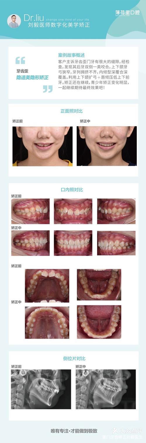 厦门牙齿矫正哪里好？求推荐靠谱的矫正机构和医生-图2