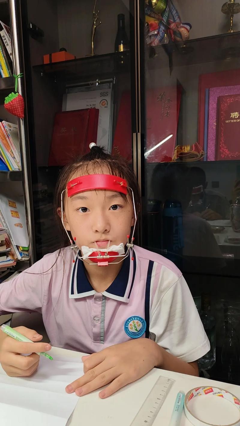 天包地牙齿矫正难度大吗？效果理想吗？需注意什么？-图2