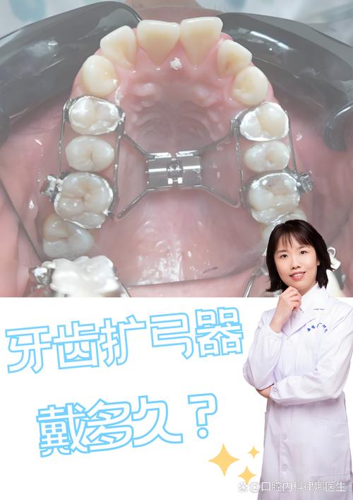 矫正牙齿一般需要多久才能看到明显的矫正效果？-图2