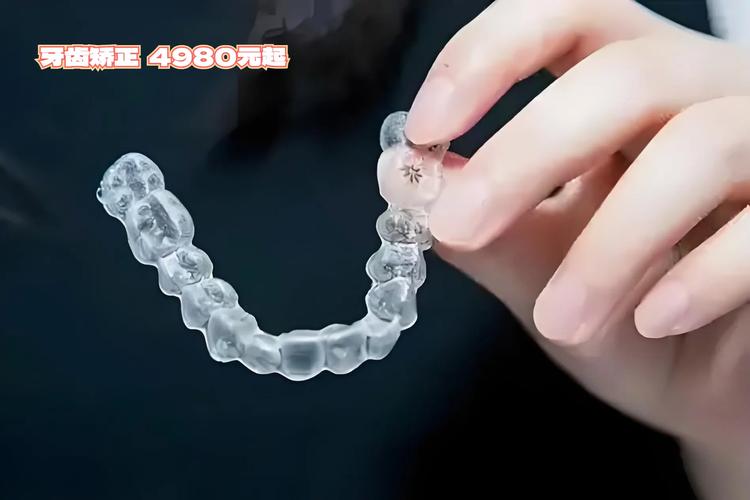 东莞牙齿矫正哪家好？求推荐技术好又价格合理的机构！-图1