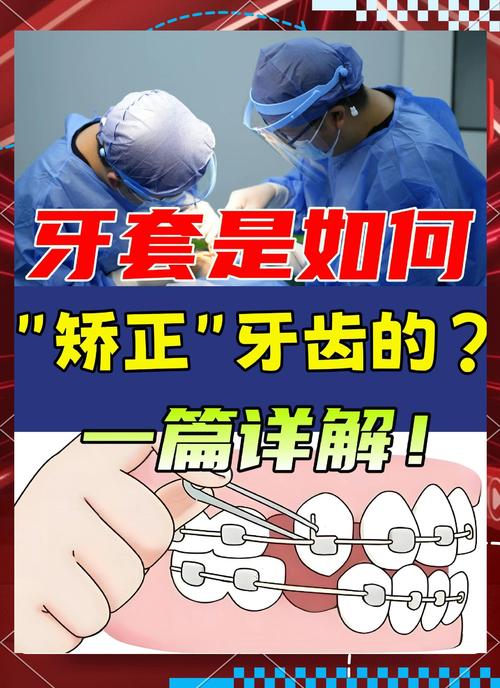 牙套矫正牙齿的原理-图3