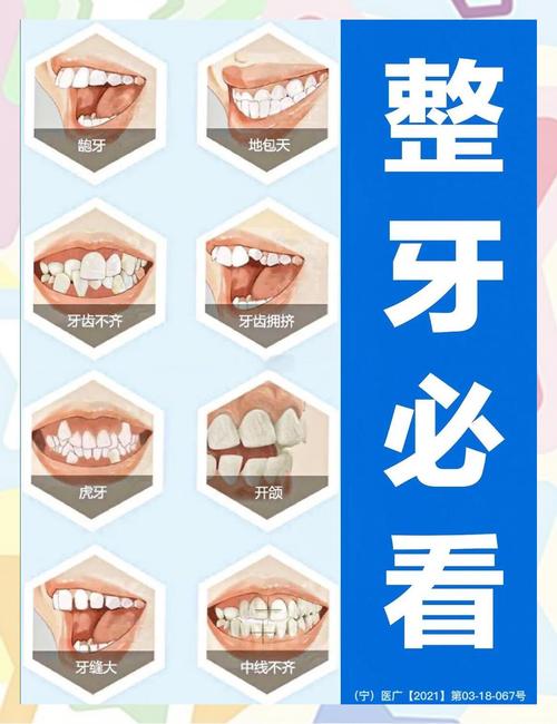 牙齿矫正属于什么科-图2 牙齿矫正属于什么科-图2