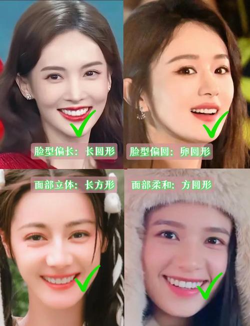 哪些明星矫正过牙齿-图3