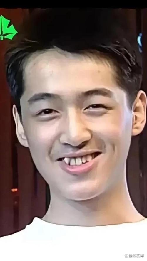 哪些明星矫正过牙齿-图2