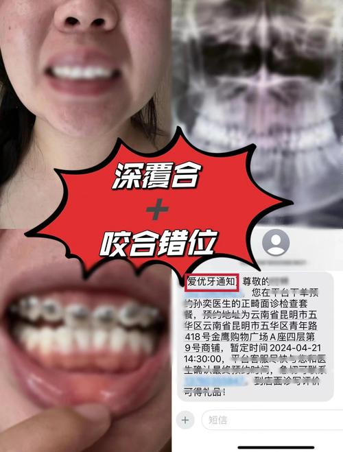 25岁能矫正牙齿吗-图1