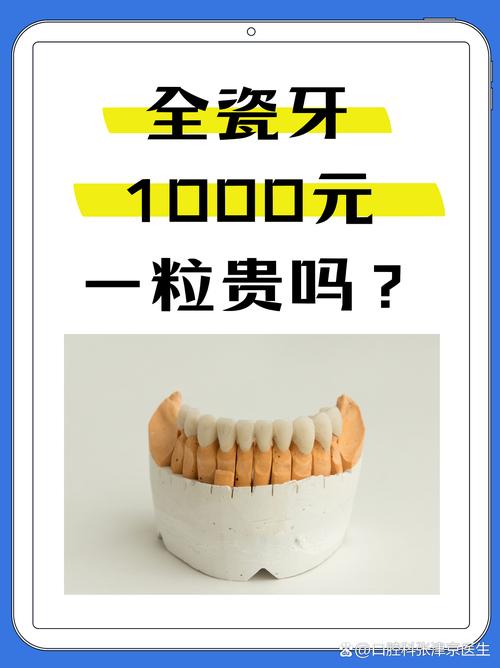 陶瓷牙齿矫正的费用大概是多少呢？-图1