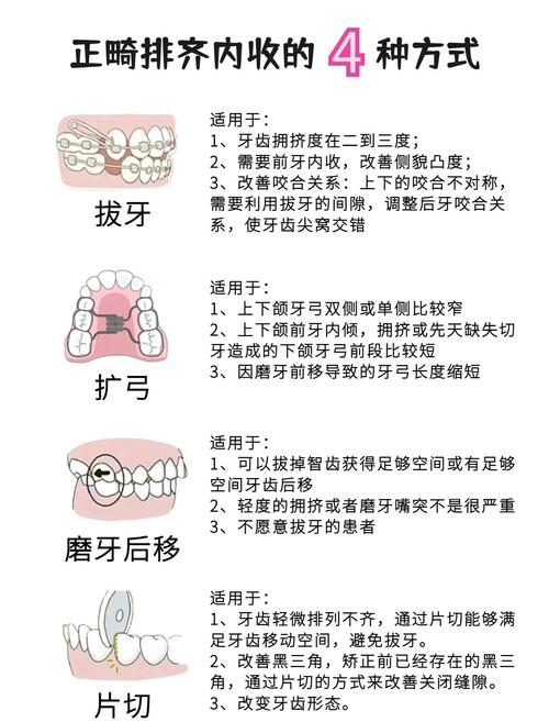 牙齿快速矫正的方法-图2