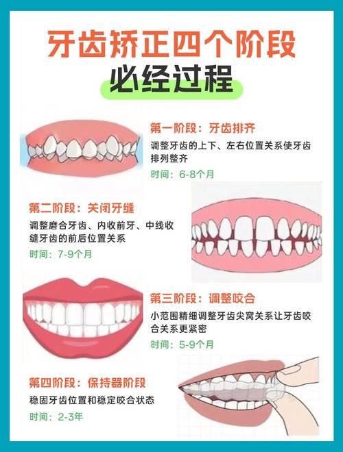 牙齿矫正可以分期吗？费用怎么算，流程是怎样的？-图1