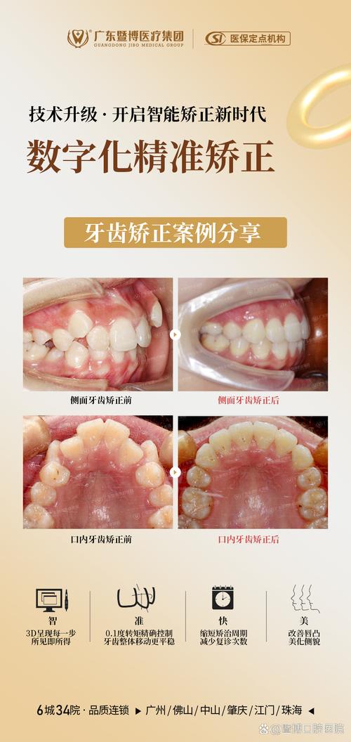 牙齿长期不矫正，会对咀嚼、美观和健康有哪些影响？-图2