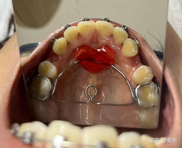 医院可以矫正牙齿吗？-图2