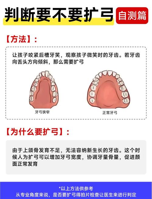 儿童牙齿矫正原理-图2