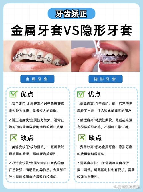 德国隐形牙齿矫正-图1