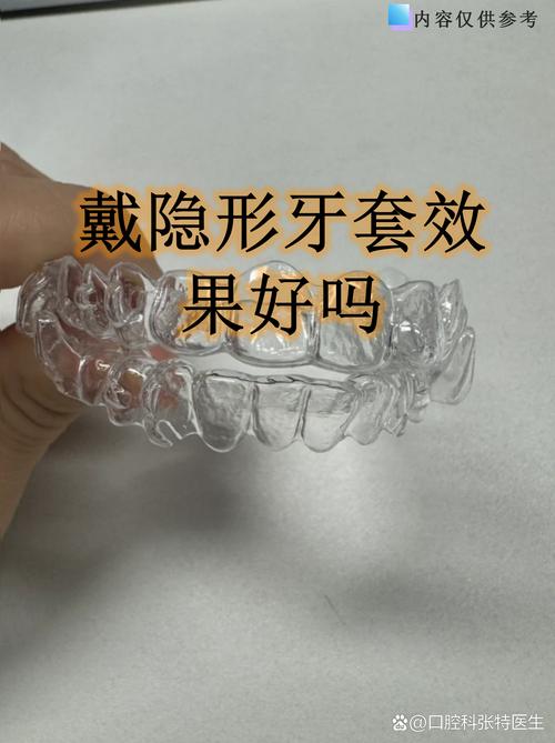 成人矫正牙齿隐形-图3 成人矫正牙齿隐形-图3