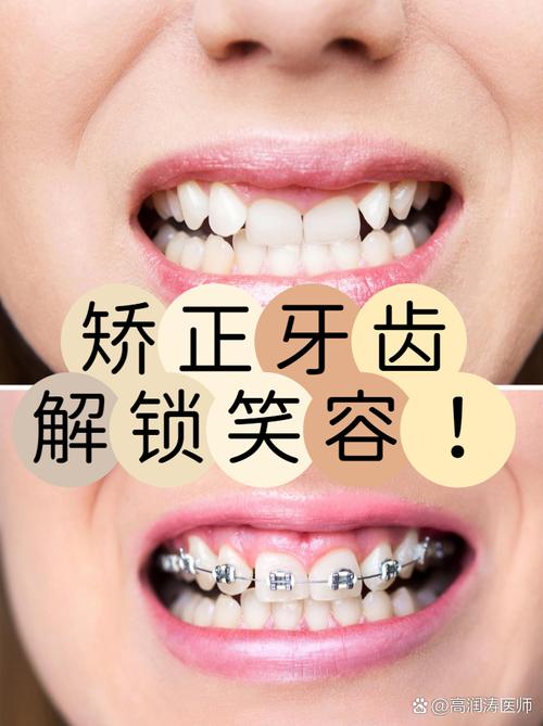 成人矫正牙齿还来得及吗？效果会受年龄影响吗？-图1
