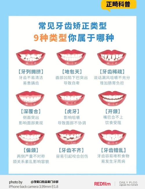 牙齿矫正客户常见疑问有哪些？-图1