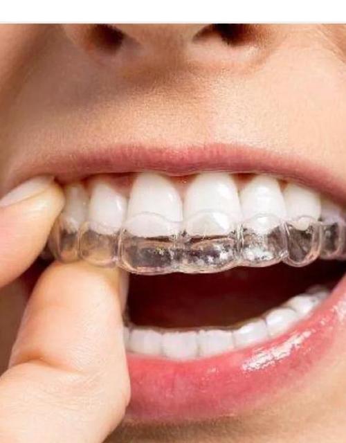 无锡牙齿矫正的最佳年龄是几岁？-图1