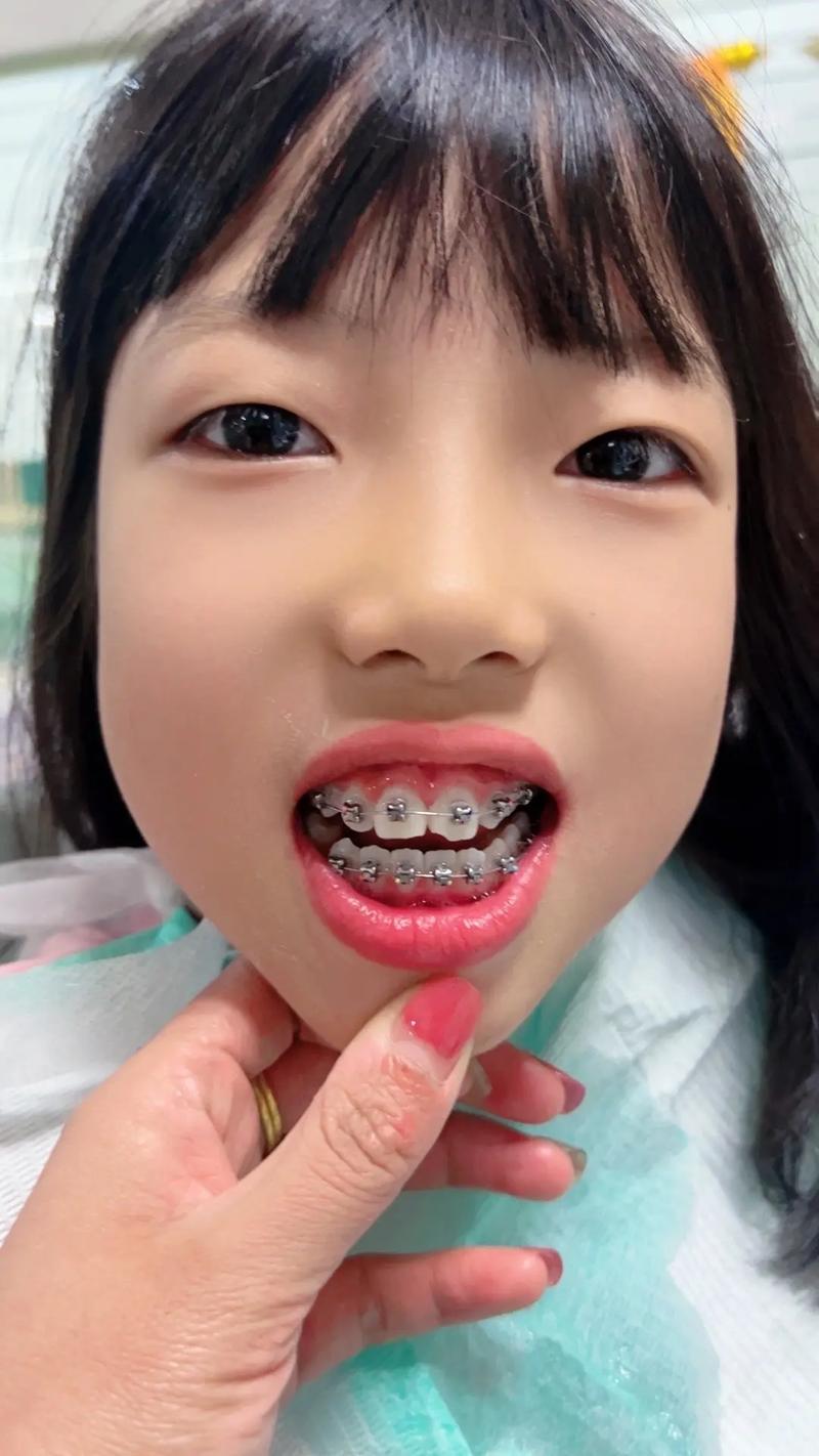 矫正牙齿为啥要拍照片？这些照片有啥关键作用？-图1