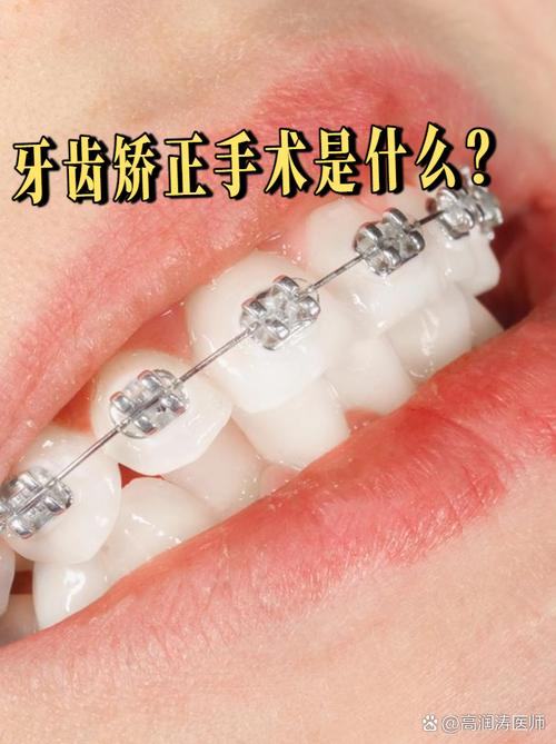 矫正牙齿保守治疗适用哪些情况?效果如何?-图2 矫正牙齿保守治疗适用哪些情况?效果如何?-图2