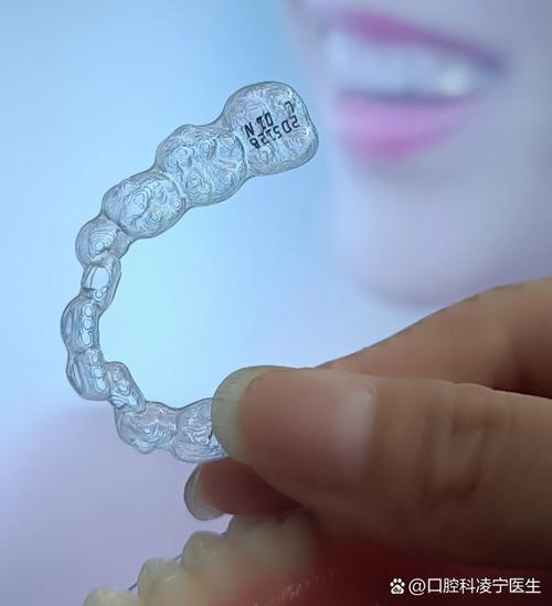 金属冰晶矫正牙齿与传统矫正有何不同？-图1