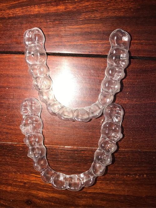 隐形矫正适合牙齿稀疏吗?-图3 隐形矫正适合牙齿稀疏吗?-图3