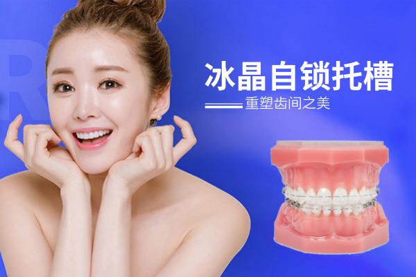 冰晶矫正牙齿效果如何？安全舒适吗？-图3