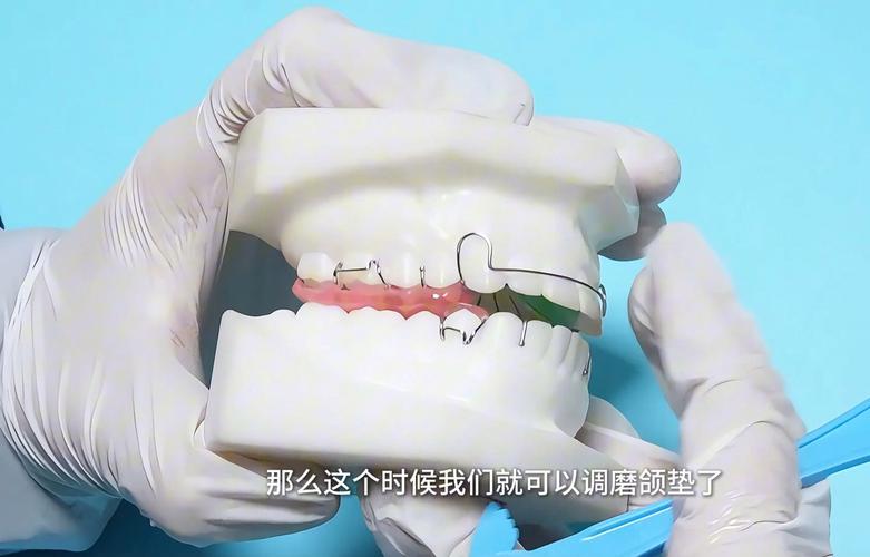 矫正牙齿加力太大，会导致牙齿松动吗？-图3