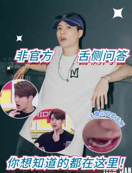 明星在哪矫正牙齿-图1