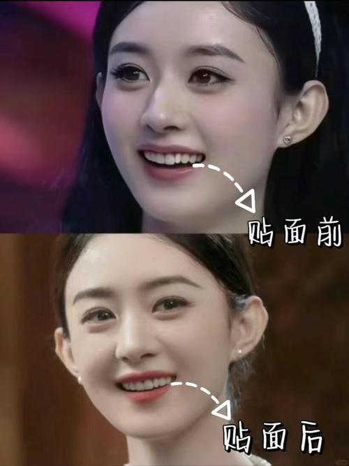 明星在哪矫正牙齿-图2